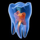 /album/fotogaleria-endodoncia/endo3-jpg/