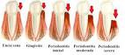 /album/fotogaleria-periodoncia/perio4-jpg/