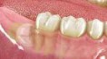 /album/fotogaleria-cirugia-oral-maxilofacial/qx1-jpg/