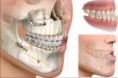 /album/fotogaleria-cirugia-oral-maxilofacial/qxmx1-jpg/
