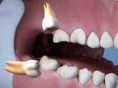 /album/fotogaleria-cirugia-oral-maxilofacial/qx3-jpg/