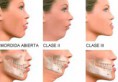 /album/fotogaleria-cirugia-oral-maxilofacial/img-2796-jpg/